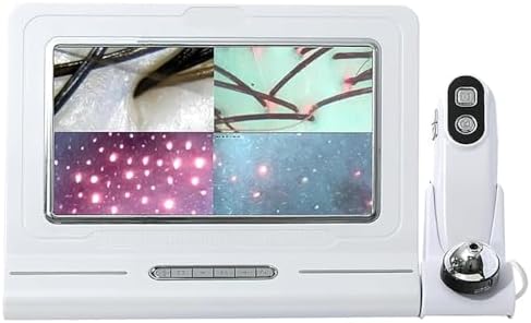 Scalp Analysis Machine & Skin Diagnostic Tool - 11" Touchscreen, Dual 50x/200x Lenses, 32GB Storage, 4 Comparison Grids for Professional Client Consultations