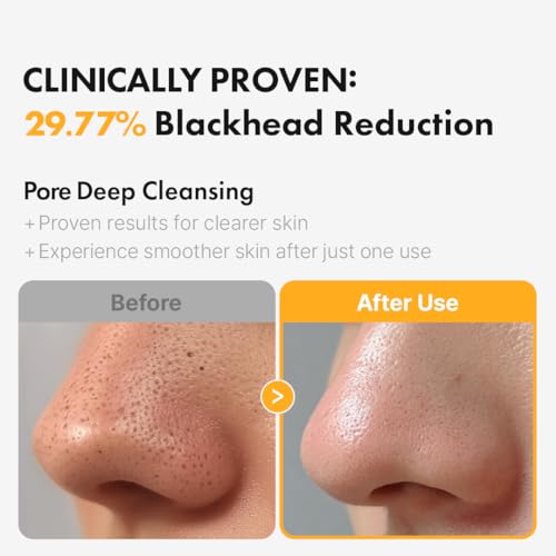 Hanskin PHA Pore Cleansing Oil + PDRN Gel-to-Foam Cleanser Set – Double Cleansing Duo for Deep Pore Care & Hydrating Glow | Vegan PDRN + Low pH Cleanser | Korean Skincare - Image 2