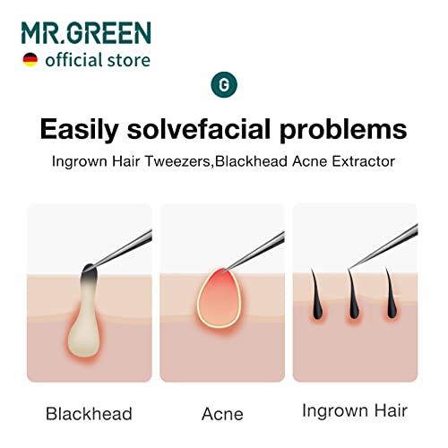 Mr.green Ingrown Hair Tweezers Needle Nose Pointed Tips Tweezers For Eyebrows Splinters Blackhead Removal Acne Clip Extractor (Long) #TOP2