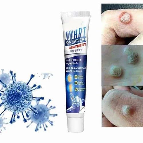 LOVE YOU MOM Wart Masa Mole Wart Remover Cream, Massa Removal Cream Pack Of 1 (100 G)