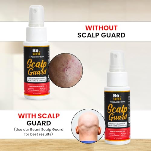 Image of Scalp Guard Protector Spray For Hair Wig And Patches Prevents Irritation From Tape And Adhesive Anti Bacterial Anti Itching Formula Improves Adhesion Pack Of 2