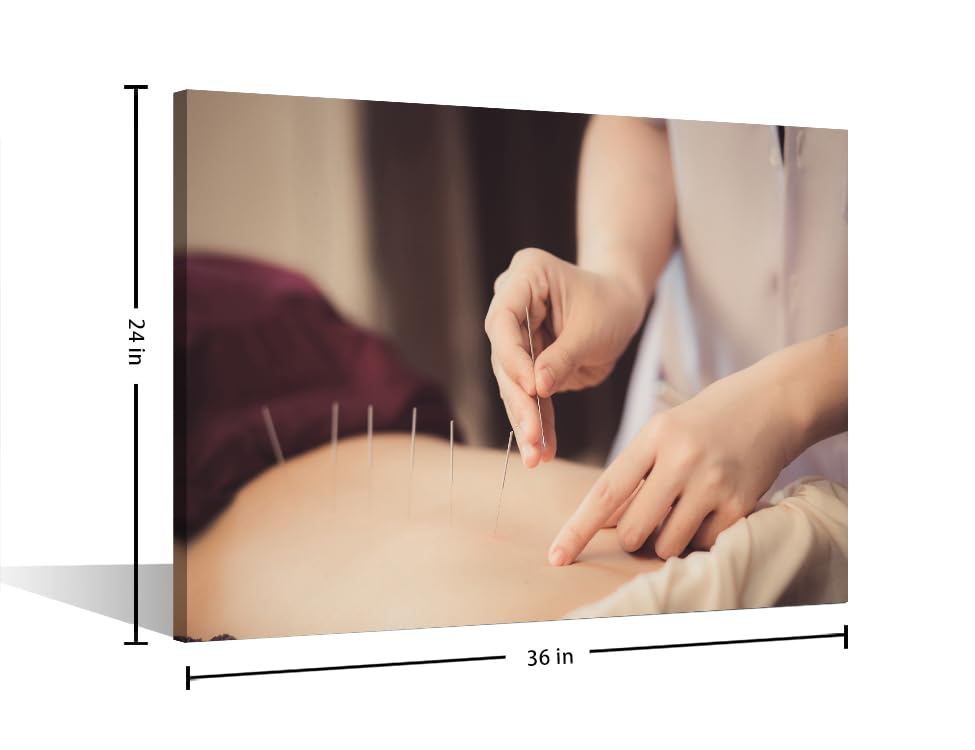 Image of TUMOVO 1 Panels Acupuncture and Moxibustion Large Wall Art Traditional Chinese Medicine Wall Art for Living Room Traditional Art Prints Giclee Print Stretched and Framed Ready to Hang (24 inch Wx36 H)