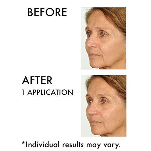 Nassifmd Hydro-Screen Bakuchiol Serum, Hyaluronic Acid Serum With Retinol Ceramide Moisturizer With Bakuchiol Oil, Retinol Serum Anti Aging Face Moisturizer For Women Face Moisturizer For Dry Skin 2Oz #TOP6