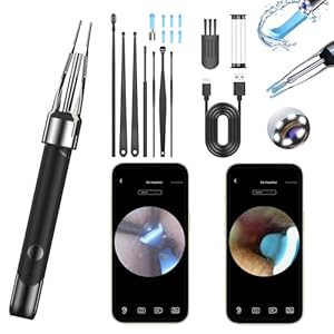 Ear Wax Removal Tool Camera | 2-in-1 Scoop & Tweezer, 5.0MP HD Otoscope | FDA-Registered WiFi Ear Cleaner with 6 LED Lights, Complete Kit for iPhone & Android