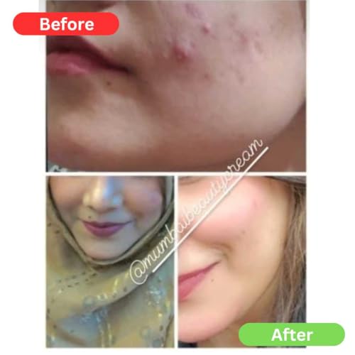 Image of Heaven Magic Bridal Night Cream | Overnight Moisturizer for Glowing Hydrated Skin | Reduces Fine Lines | Boosts Cell Renewal | See Results in 7 Days | For All Skin Types.