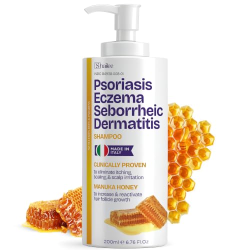 Image of Psoriasis Shampoo for Eczema, and Folliculitis Treatment - Seborrheic Dermatitis Antifungal Shampoo for Ringworm, Acne, Flaking, Dry & Itchy Scalp Treatment - Psoriasis Relief with Manuka Honey