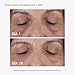 MASDERM Imagen de MASDERM