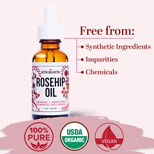 Better Shea Butter Pure Rosehip Seed Oil | Coldpressed Usda Organic Certified Facial Serum, Carrier Oil, Hair, Skin, & Nail Treatment For Women And Men #TOP3