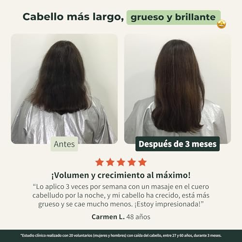 Miniatura 6 de Bionoble Aceite De Romero Para El Cabello Orgánico - Estimula Crecimiento Y Reduce Caída - Aceite Esencial De Romero Y Aceite De Ricino - Rosemary Oil Hair Growth - Botella De Vidrio Bomba - 200ml
