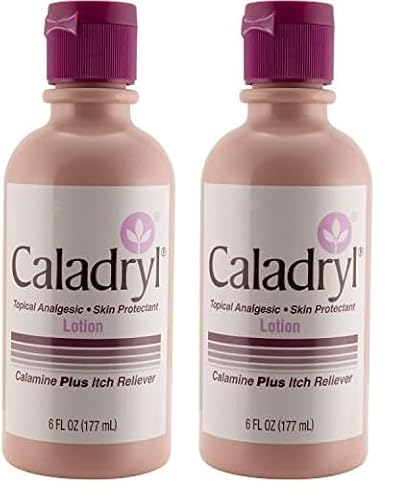 Caladryl Calamine Lotion, Skin Protectant Plus Itch Relief, 6 Fl Oz (Pack of 2)