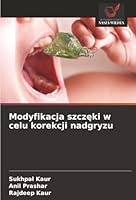 Modyfikacja szczeki w celu korekcji nadgryzu (Polish Edition) 6208899222 Book Cover
