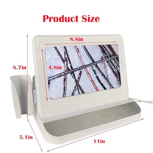 Professional Scalp Camera with 11-Inch HD Screen - High-Definition Hair & Scalp Analysis Device for Salons and Spas, Easy to Use, Ideal for Scalp Care & Client Consultations - Image 6