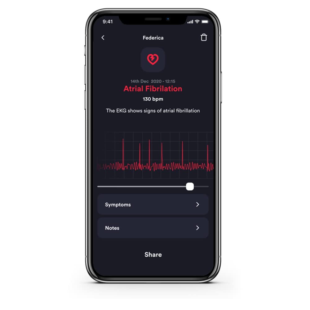 Cardionica Moniteur ECG Portable Professionnel À Canal Unique | Électrocardiographe Portable Pour Électrocardiogramme Professionnel | Électrocardiogramme Portable et Compteur Fibrillation Atriale | Diagnostic cardiaque en 1 minute – Détection clinique de