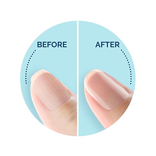 Scholl Velvet Smooth Elektronisches Nagelpflegesystem, blau, 1 Stück