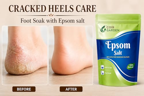 Image of Coir Garden Epsom Salt 1 Kg for Foot Soak, Bath & Wellness - Pure Magnesium Sulfate Bath Salt for Relaxation, Muscle Relief, Self Care, Plants & Gardening