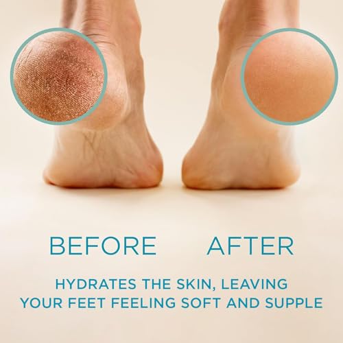 lee beauty 8oz professional gel callus remover for feet - original fast-acting formula extra strength for cracked heels amp dead skin pack of 1