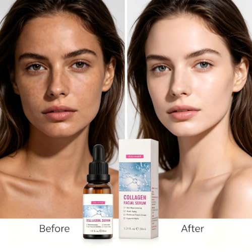 Image of Dark Spot Corrector With Anti-Aging Melasyl + 10% Niacinamide, Discoloration Correcting Serum for Sun Spots, Age Spots & Post-Acne Marks Korean Skincare | 1.01 fl.oz. (Collagen essence)