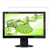 Auto-cicatrisant, les égratignures vont s'affaiblir dans 48 heures.