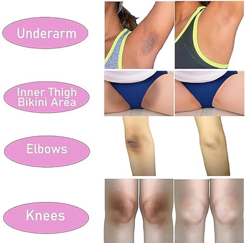 Ceavo Skin Lightening Cream for Intimate Area with Niacinamide, Arbutin, Tranexamic Acid, Vitamin C, Even Skin Tone For Body Private Part, Underarm, Knees, Elbows, Inner Thigh, Bikini Bleaching Whitening