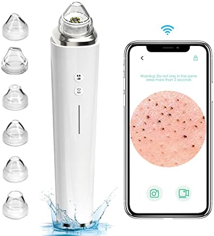 NASONEB Blackhead Remover Pore Vacuum,Visual Pore 20x Magnification, USB Charging, Electric Vacuum Facial Pore Cleaner Acne Extractor Tool