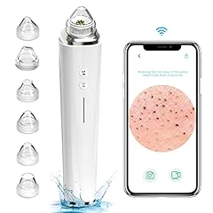 Prabensei Mitesserentferner mit Kamera...