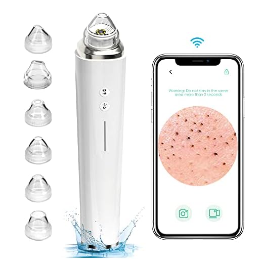 Prabensei Mitesserentferner mit Kamera, Vakuum-Sauger Porenreiniger 20X Mikroskop 5.0 MP, 3 Saugstufen & 6 LED-Licht & 6 Sonden