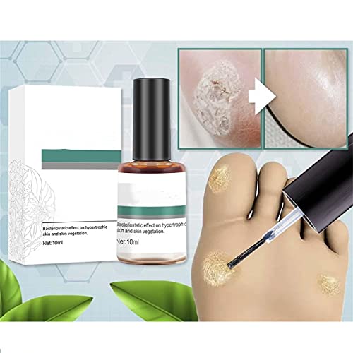 List of Ten Best Corn Removal [Experts 2023 Reviews]