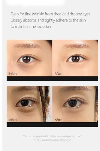 DRMELAXIN-Cemenrete-Calcium-Dark-Spot-Eye-Cream-15g