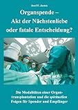 Organspende - Akt der Nächstenliebe oder fatale Entscheidung?: Die Modalitäten einer Organtransplantation und die...