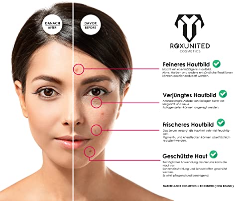Hyaluronsäure Serum von Roxunited Hochdosiert für intensive Feuchtigkeit