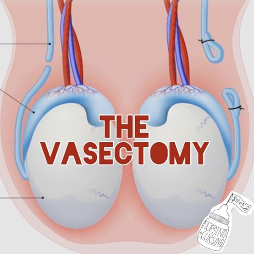 S5 Ep9: THE VASECTOMY