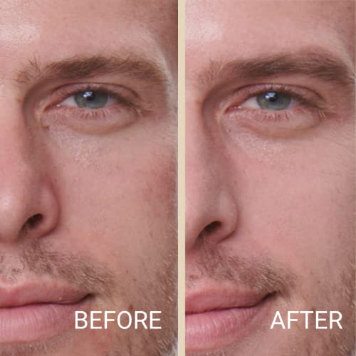 Mattr Skin Fix, Concealer For Men, Conceals Blemishes, Improves Skin Tone, Fixing Dark Circles, Vegan, Men Skin Care, Cruelty-Free, 15 Grams (F1) #TOP1