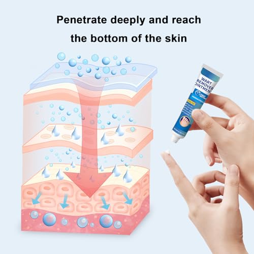 Wart Remover Ointment with 17% Salicylic Acid for Common, Flat, Plantar Warts and Corns (Blue) - Image 6