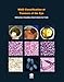 WHO Classification of Tumours of the Eye (Medicine)