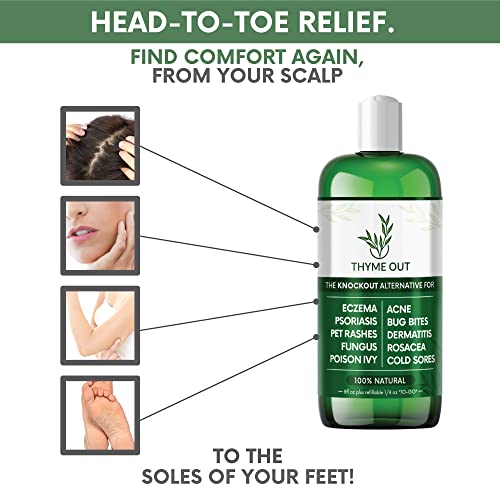 All Natural Eczema Treatment- Psoriasis Treatment - An All-In-One Solution For Acne, Dermatitis, Rosacea, Cold Sores, Pet Rashes, Bug Bites, And Poison Ivy - Anti-Itch Spray For Itchy Skin Relief For Kids, Adults, And Babies #TOP6
