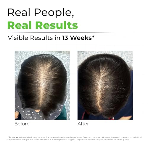 Image of Avimee Herbal Rosemary Oil for Hair (Pack of 2)| For Hair Growth, Hair Fall Control and Dandruff | 100% Pure & Natural | Mineral Oil Free | 100mL