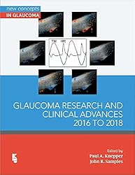Amazon.co.jp: Glaucoma Research and Clinical Advances: 2020 to