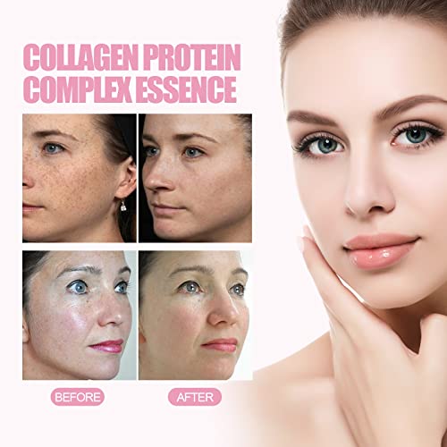 2022 New Sheep Placenta Collagen Serum Luxury, Blemish Skin Corrector Serum 10% Luxury, New Blemish Skin Corrector Serum, Dark Spot Corrector Serum, Blemish Skin Corrector Serum (3Pcs) #TOP5