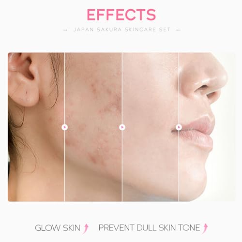 Hautpflege Set für Teenager-Mädchen, Japan Sakura Skincare Set, Anti-aging Gesichtspflege Set, Tägliche Skin Care Set Frauen - Reinigung Toner Serum Creme Augenmaske Gesichtsmaske Lippenmaske – Bild 4