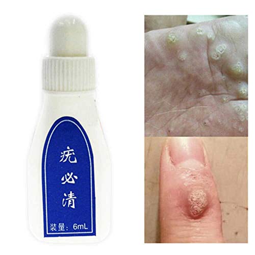 Fission 12 Hours Tu Kill -Wart Remover Skin Tag Mole & Genital Wart Remover
