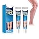 Wonsters 2pc Krampfadern Creme, Venensalbe Creme Gegen Krampfadern, Varicose Veins Cream, Varicose Veins Relief Cream, Venensalbe Creme Gegen Krampfadern