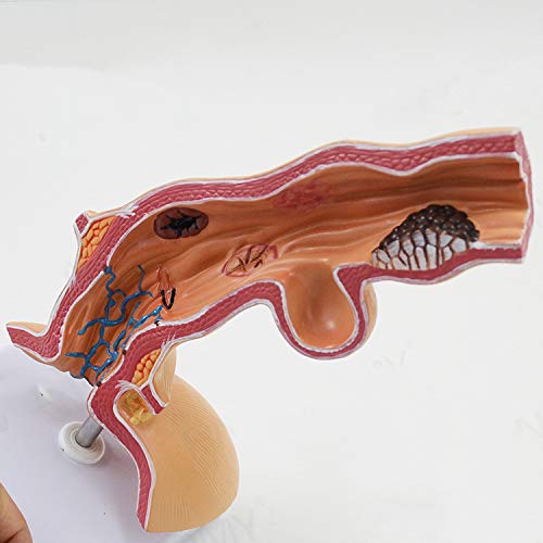 Sjdopulse Human Esophagus Anatomical Model - Educational Model Human Body Esophagus Organ Anatomy Model - Medical Anatomical Department Of Esophagus And Digestive System Model