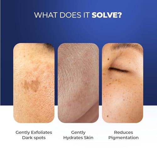 Image of Aqueria Hydrating & Brightening French Face Wash with Creamide Complex | Deep Cleansing, Non-Drying, Non-Stripping Gentle Cleanser for Dry to Normal, Sensitive Skin | Alpha Arbutin, Niacinamide, Fruit AHA BHA & Hyamagic-4D for Barrier Support & Even-Toned Skin | Reduces Pigmentation & Tanning | Dermatologist Validated, Fragrance Free, Gentle Foaming Formula |100ml