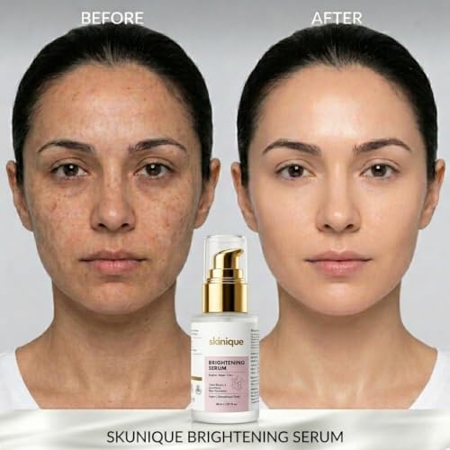 Image of Brightening Serum 30ml With Japanese Claire Blanche-II, Glutathione, Kojic Dipalmitate & Alpha Arbutin Serum | Brighten - Barrier Repair - Glow | Soft & Smooth Skin, Helps Reduce Dark Spots, Uneven Skin Tone & Dullness