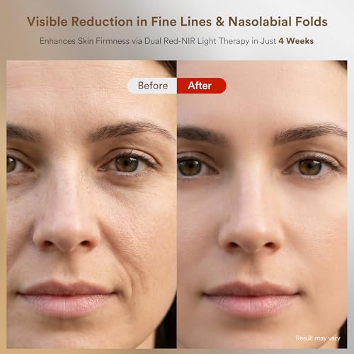 4 Color LED Face Mask Light Therapy, Red Light Therapy for Face, FDA Cleared with 324 Medical Grade Chips, 3 Modes for Anti Wrinkle & Acne, At-Home Skin Tightening Device, Luxury Beauty Gift - Image 6