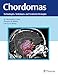 Produktbild Chordomas: Technologies, Techniques, and Treatment Strategies