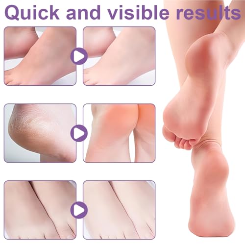 EIH1 3 Pares Mascarilla Pies Exfoliante, Máscara Pies Peeling, Mujeres y Hombres Quitar Piel Muerta y Callos, Lavanda - imagen 3