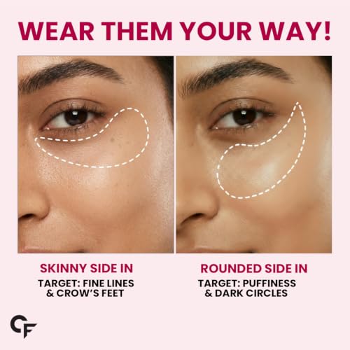 Image of Carbamide Forte Hydrogel Under Eye Patches For Dark Circles | Under Eye Mask with Caffeine, Rose Extract, Niacinamide | Reduces Dark Circles & Puffiness | Hydrating & Brightening Eye Patches | 60 Patches (30 Pairs)