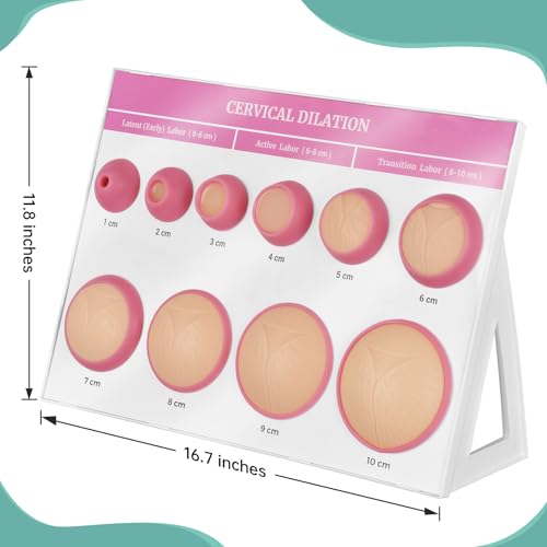 Image of Cervical Dilation Simulator Board with 1-10cm for Midwife and Doula Training, Gynecological Examination Model,Chart on Display Board Medical Education, and Birth Learning