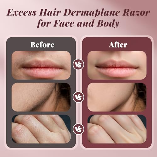 Dermaplane Razor for Women Face, BNU Facial Hair Remover for Anti-Aging, Rechargeable, LED Light, Sonic Edges, 3 Speeds, Ergonomic Handle Face Dermaplaning Tool 10 Blades Pink by BNU - Image 7